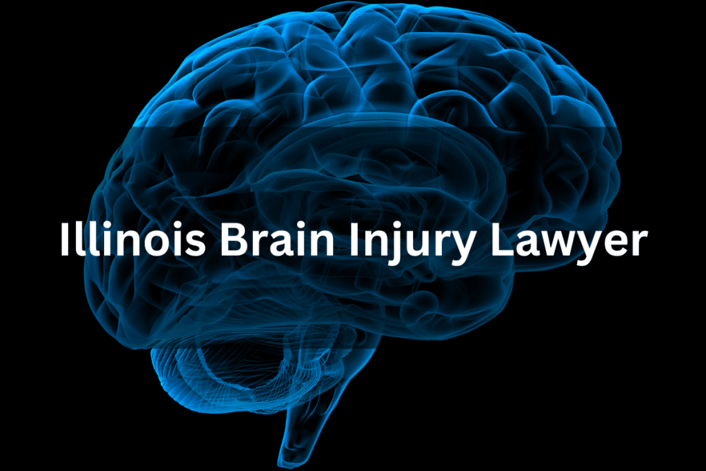 The image shows a brain with an overlay of text that reads "Illinois Brain Injury Lawyer."
